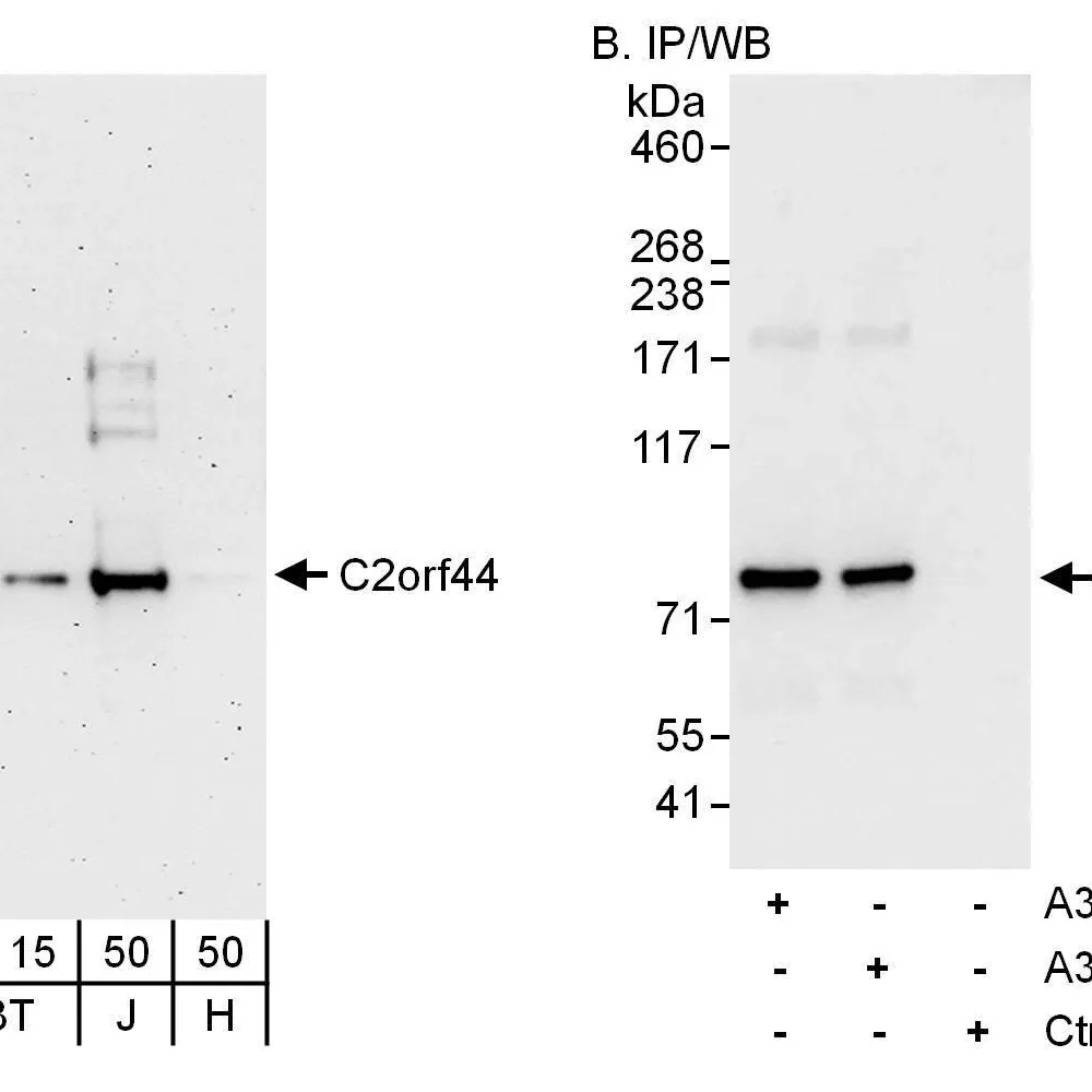 Rabbit anti-C2orf44 Antibody, Affinity Purified