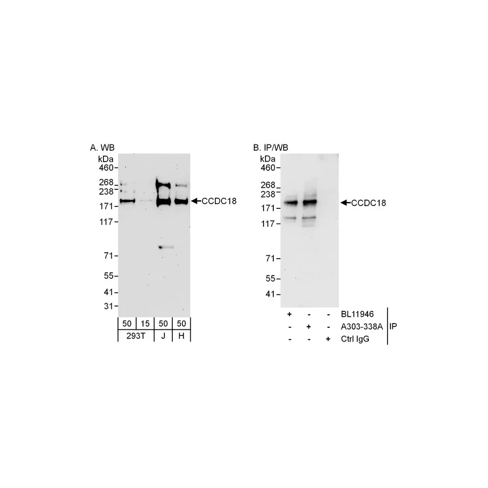 Rabbit anti-CCDC18 Antibody, Affinity Purified
