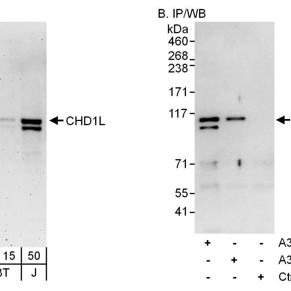 Rabbit anti-CHD1L Antibody, Affinity Purified