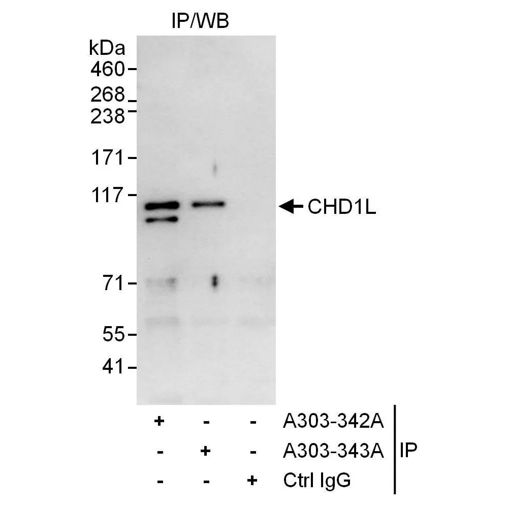 Rabbit anti-CHD1L Antibody, Affinity Purified