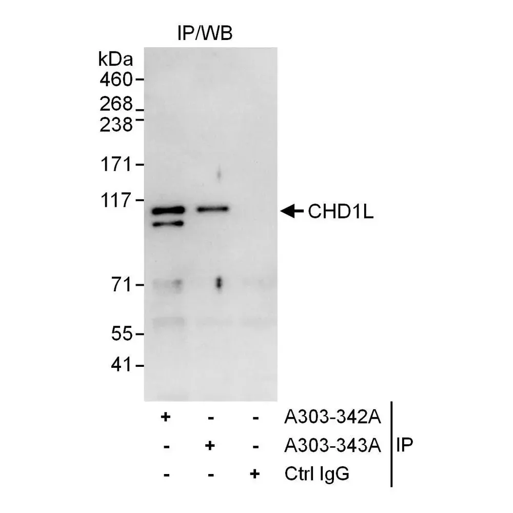 Rabbit anti-CHD1L Antibody, Affinity Purified