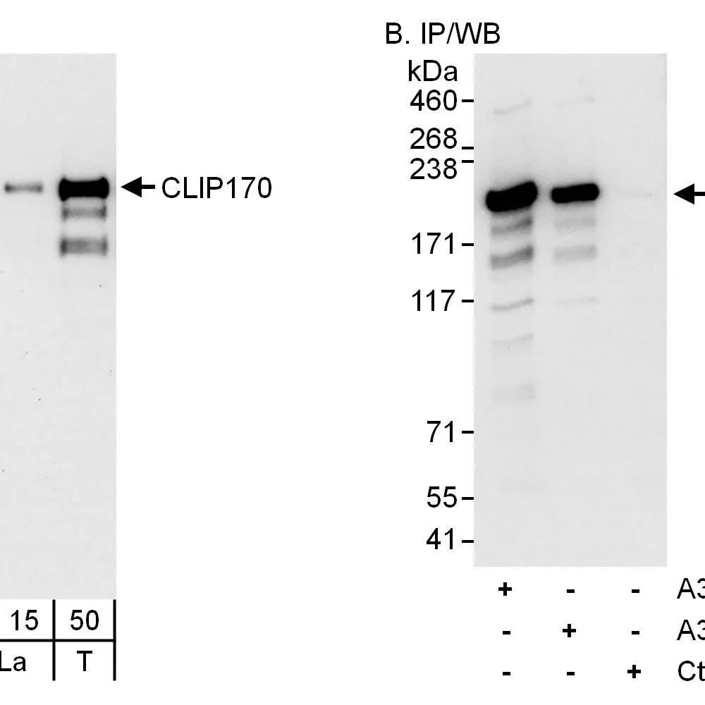 Rabbit anti-CLIP170 Antibody, Affinity Purified