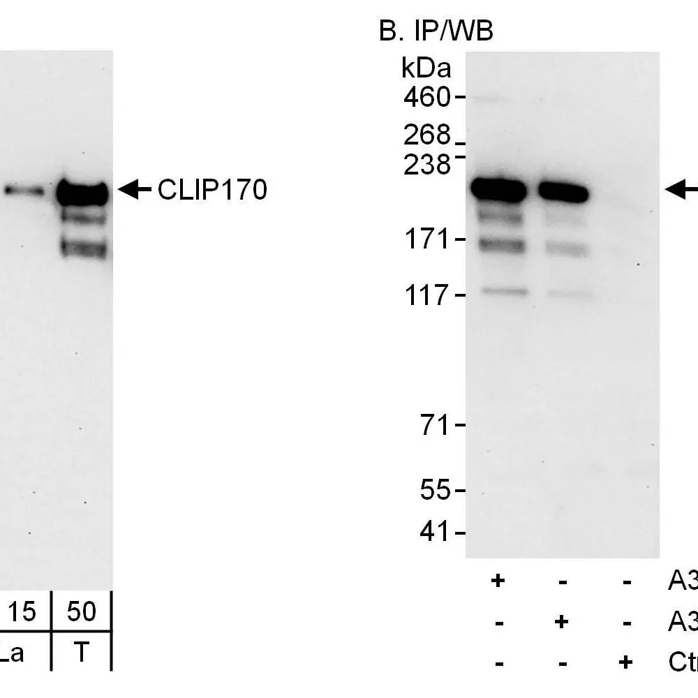 Rabbit anti-CLIP170 Antibody, Affinity Purified