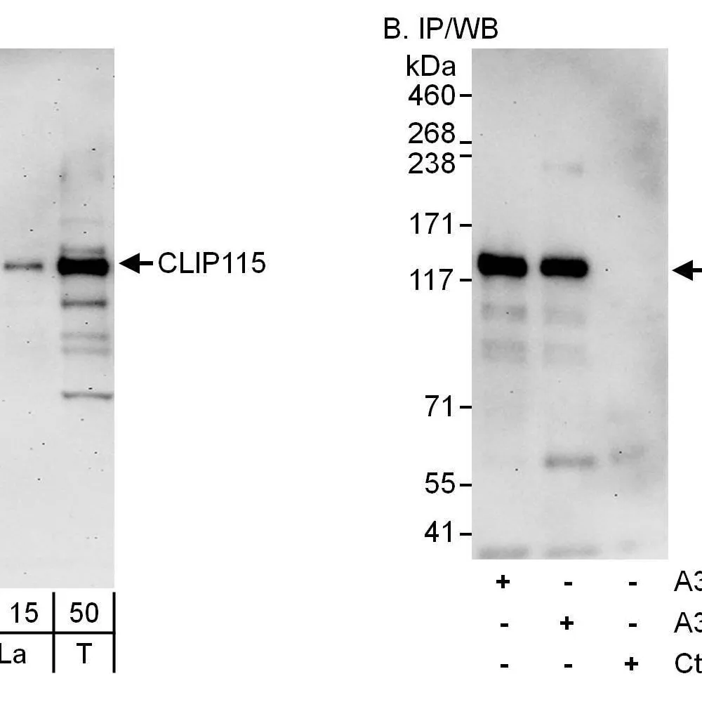 Rabbit anti-CLIP115 Antibody, Affinity Purified