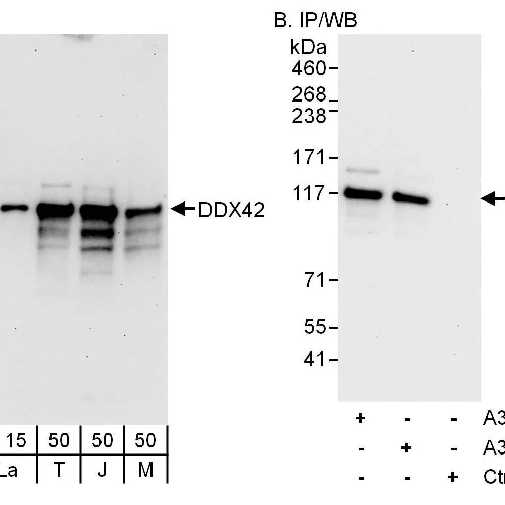 Rabbit anti-DDX42 Antibody, Affinity Purified