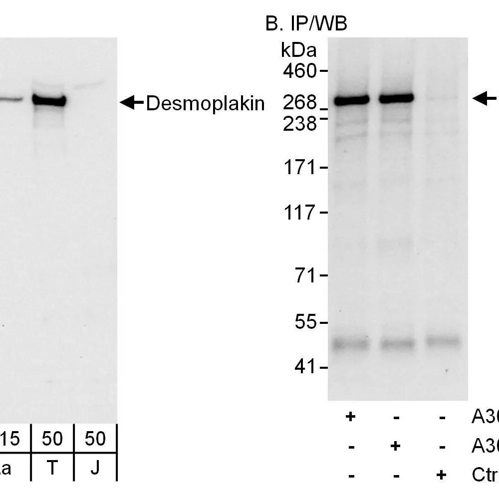 Rabbit anti-Desmoplakin Antibody, Affinity Purified