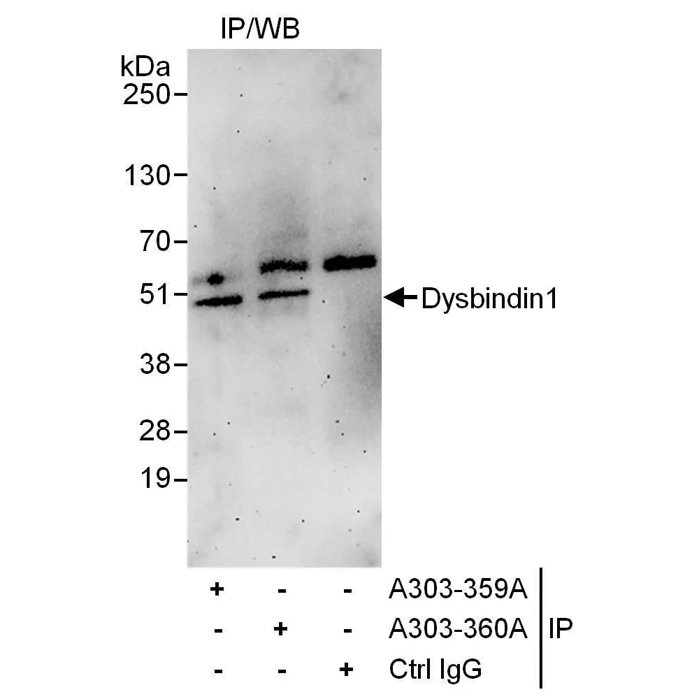 Rabbit anti-Dysbindin1 Antibody, Affinity Purified