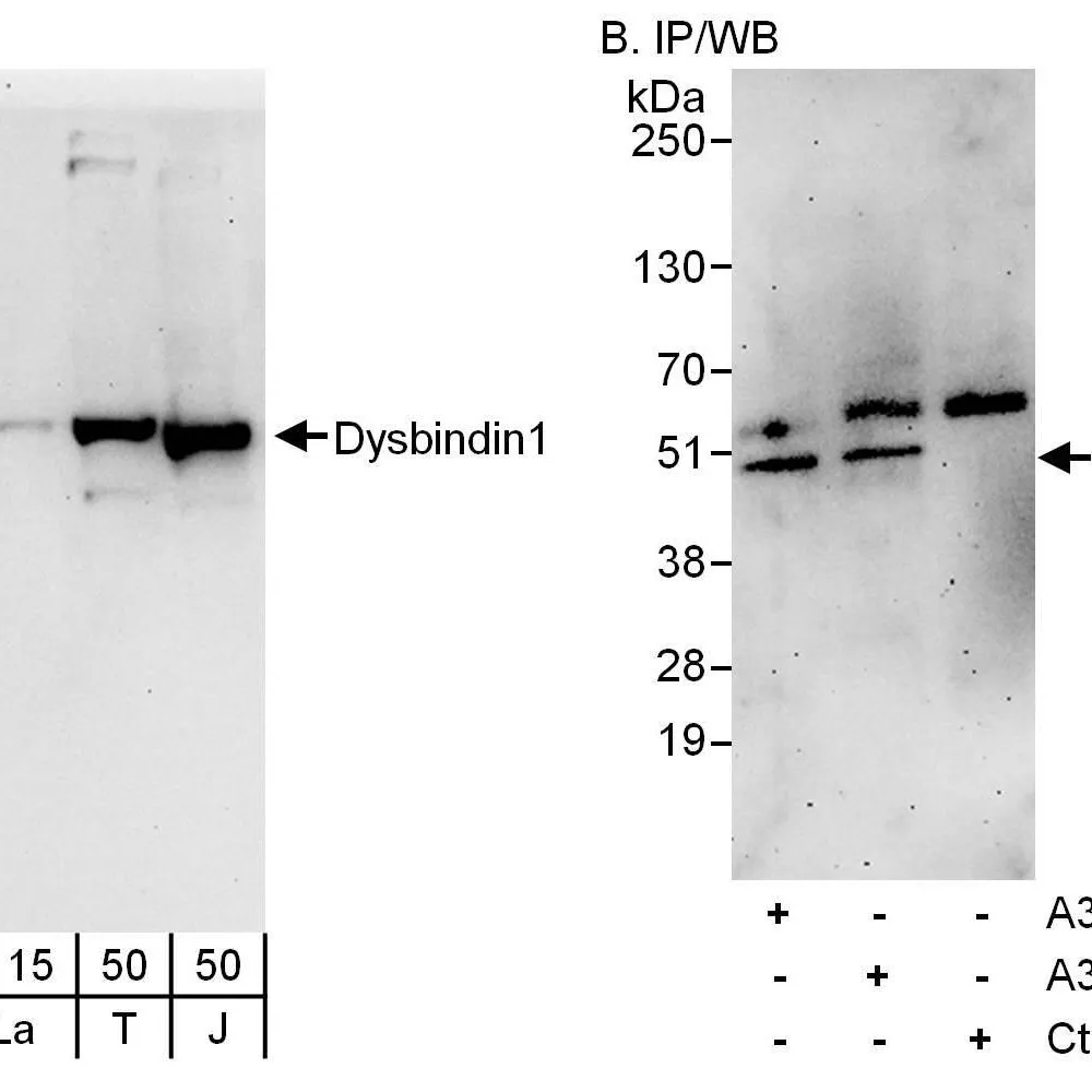 Rabbit anti-Dysbindin1 Antibody, Affinity Purified