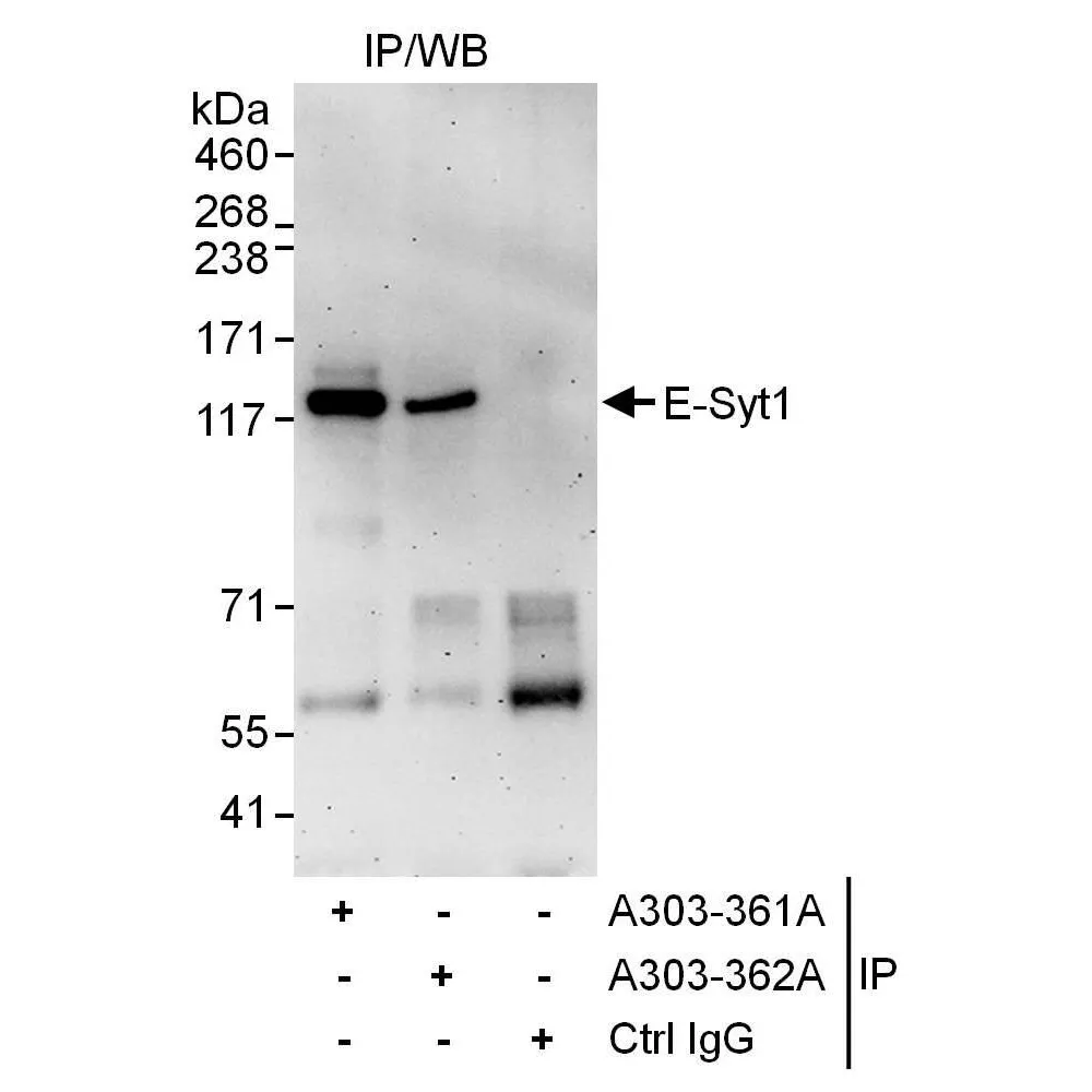 Rabbit anti-E-Syt1 Antibody, Affinity Purified