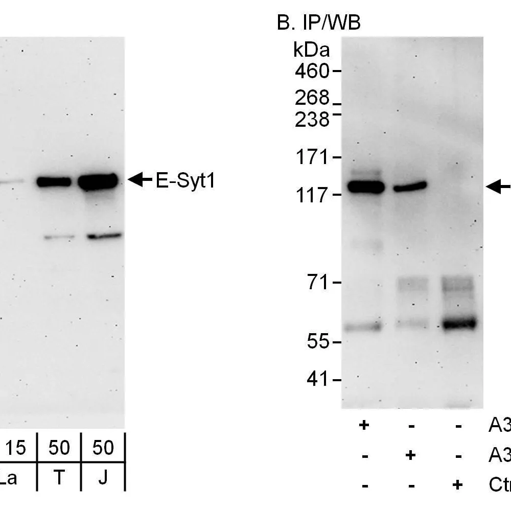 Rabbit anti-E-Syt1 Antibody, Affinity Purified