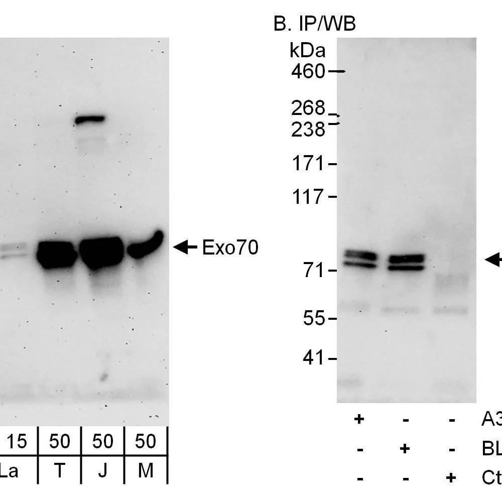 Rabbit anti-Exo70 Antibody, Affinity Purified