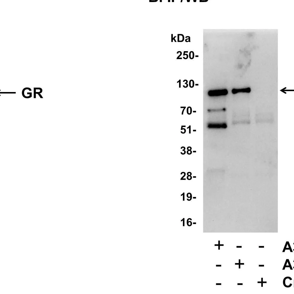 Rabbit anti-GR Antibody, Affinity Purified