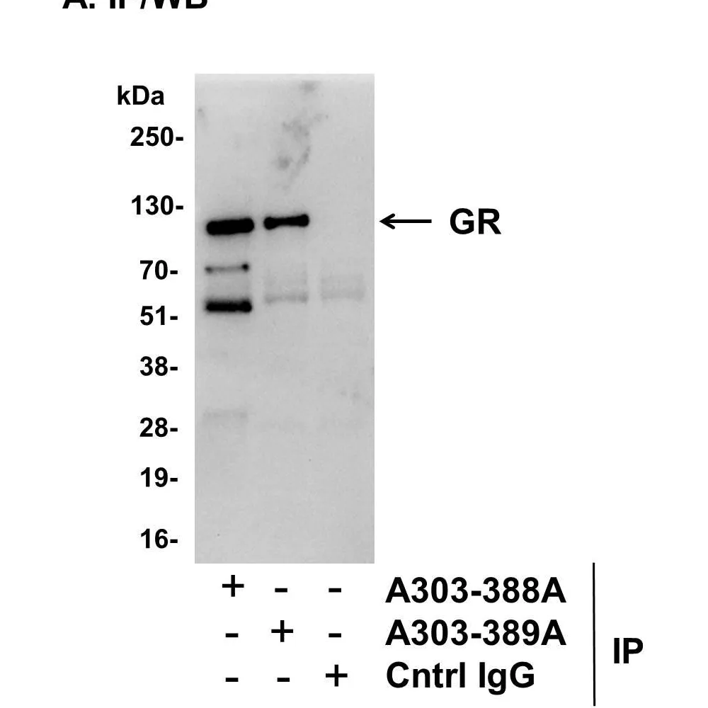 Rabbit anti-GR Antibody, Affinity Purified