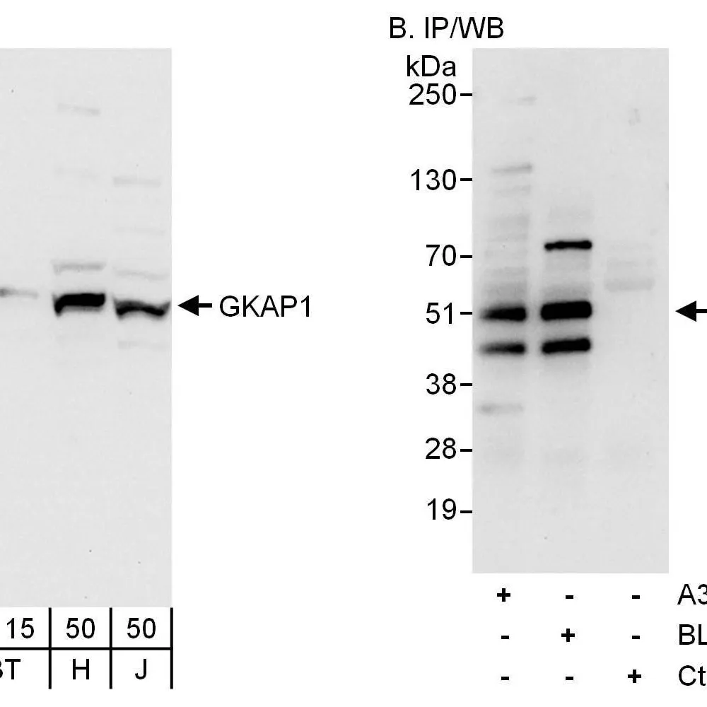 Rabbit anti-GKAP1 Antibody, Affinity Purified