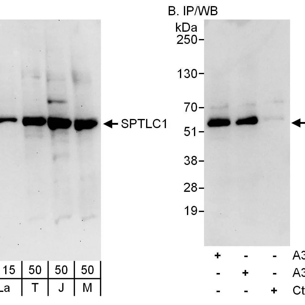 Rabbit anti-SPTLC1 Antibody, Affinity Purified