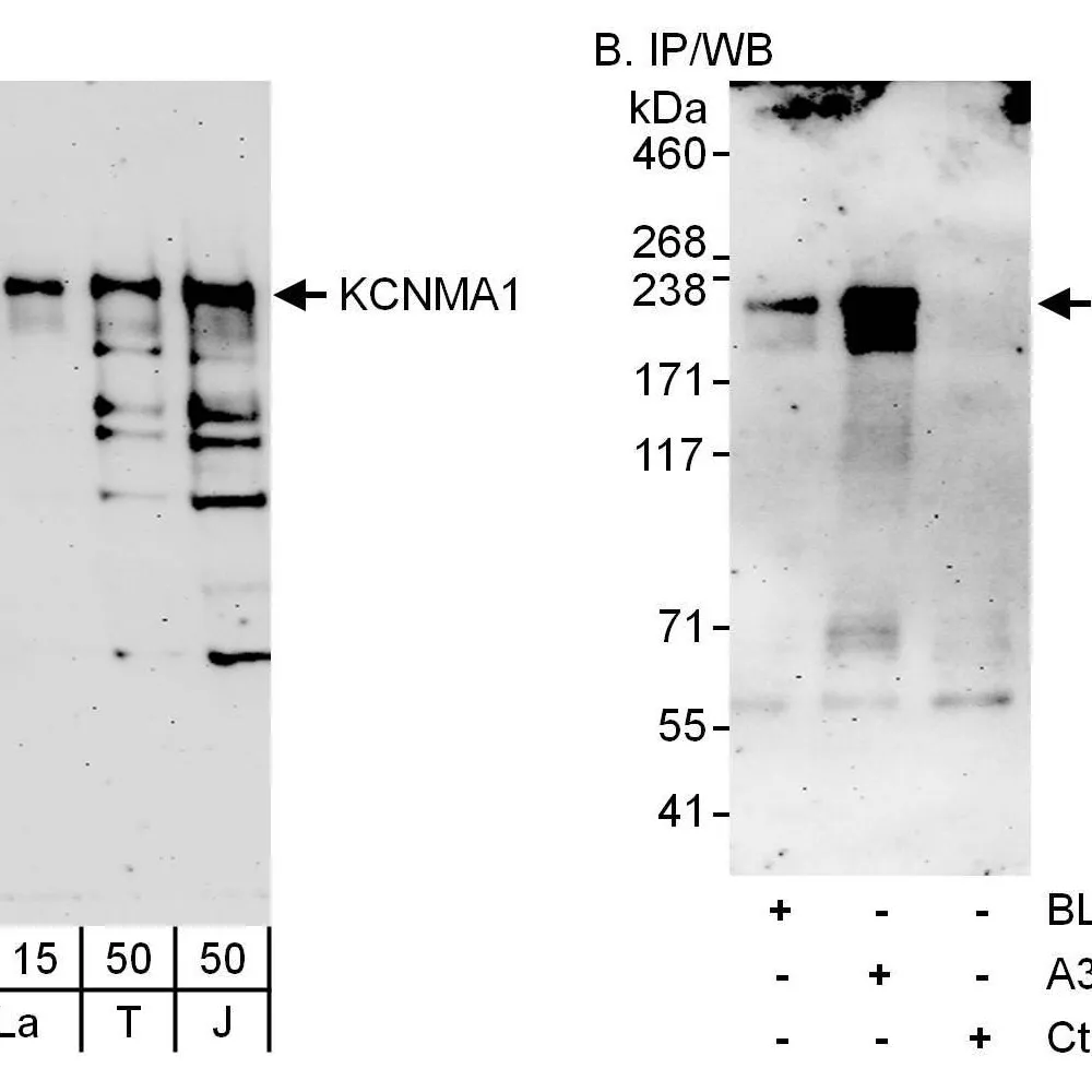 Rabbit anti-KCNMA1 Antibody, Affinity Purified