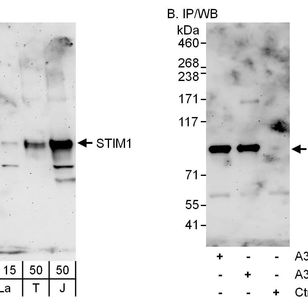 Rabbit anti-STIM1 Antibody, Affinity Purified