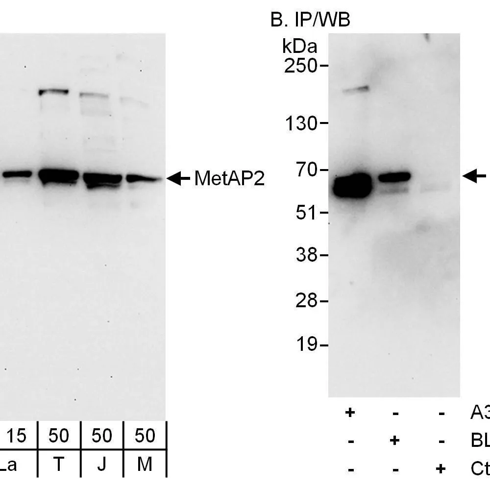 Rabbit anti-MetAP2 Antibody, Affinity Purified