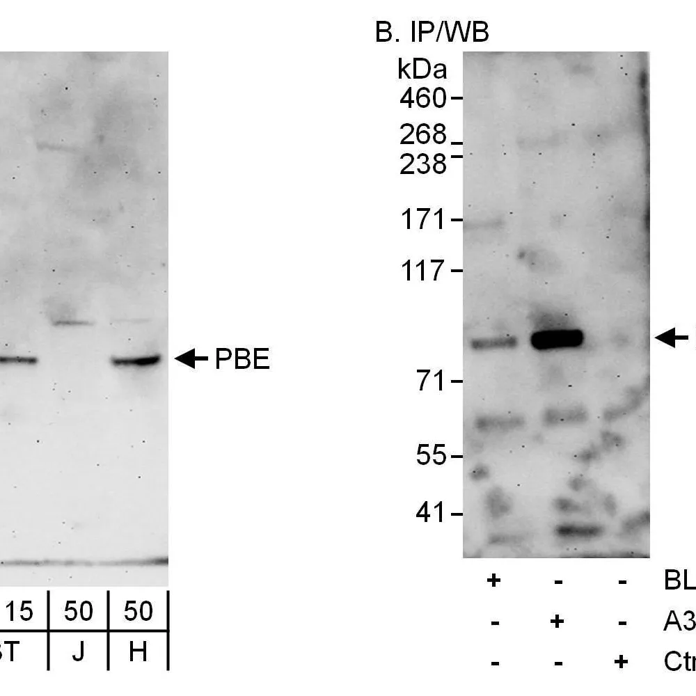 Rabbit anti-PBE Antibody, Affinity Purified