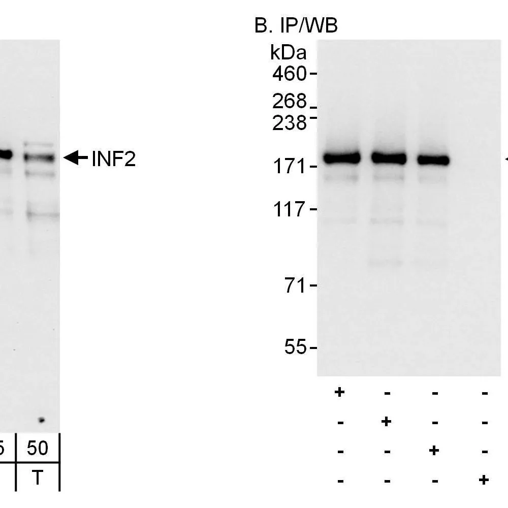Rabbit anti-INF2 Antibody, Affinity Purified