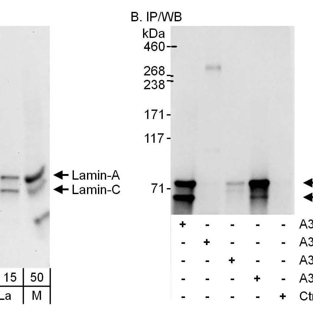 Rabbit anti-Lamin-A/C Antibody, Affinity Purified