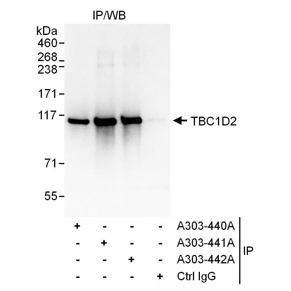 Rabbit anti-TBC1D2 Antibody, Affinity Purified