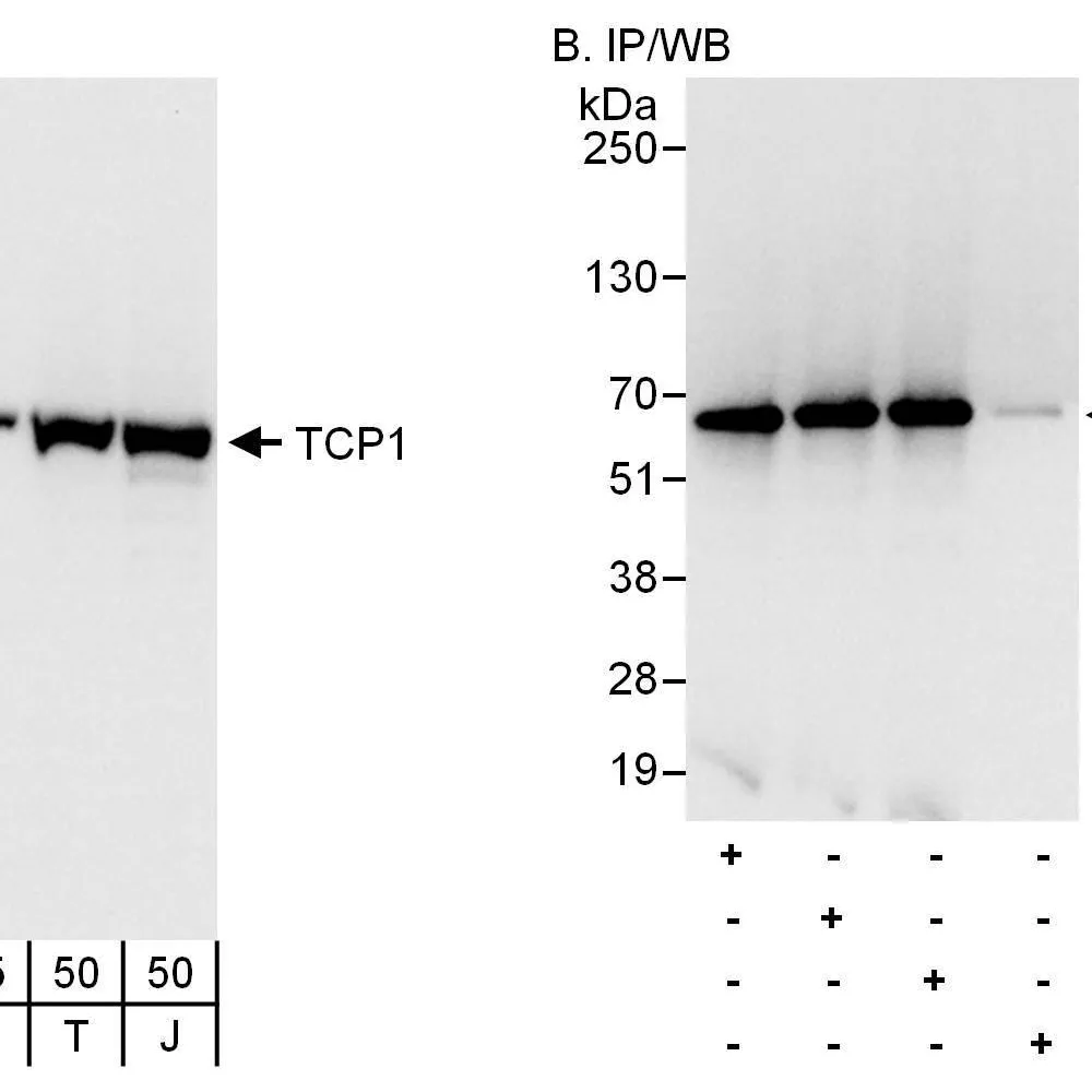 Rabbit anti-TCP1 Antibody, Affinity Purified