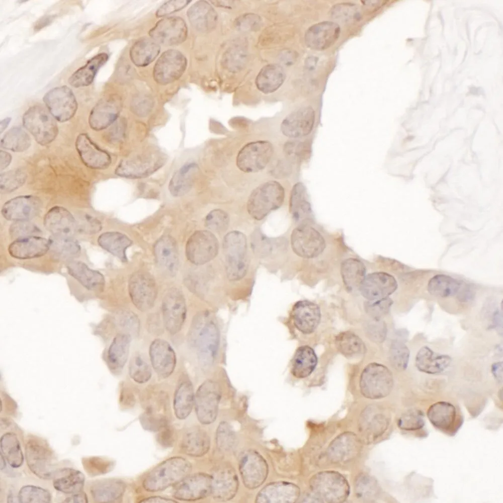 Rabbit anti-CCT8 Antibody, Affinity Purified