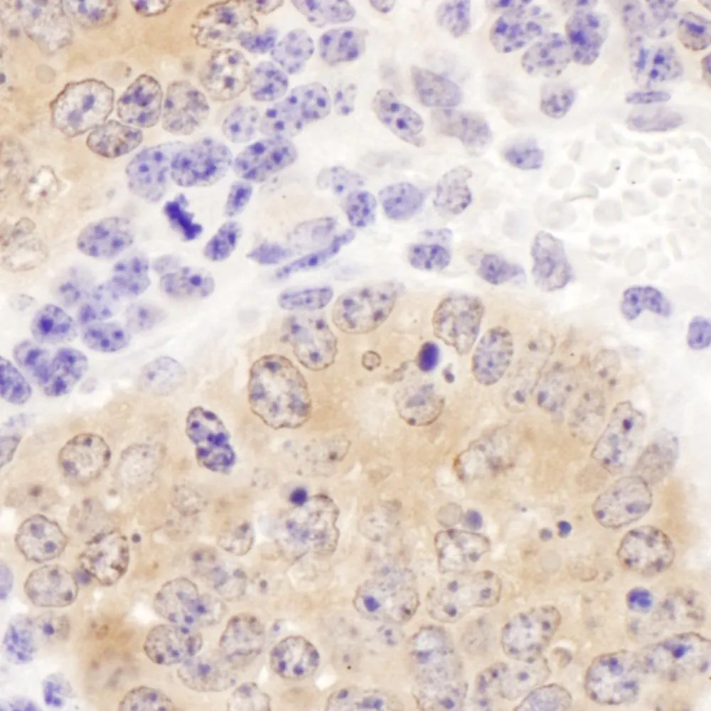 Rabbit anti-CCT8 Antibody, Affinity Purified