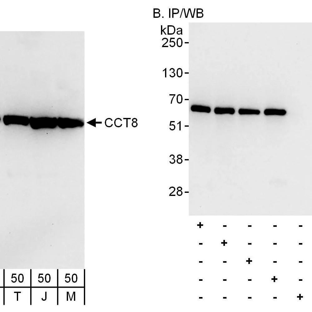 Rabbit anti-CCT8 Antibody, Affinity Purified