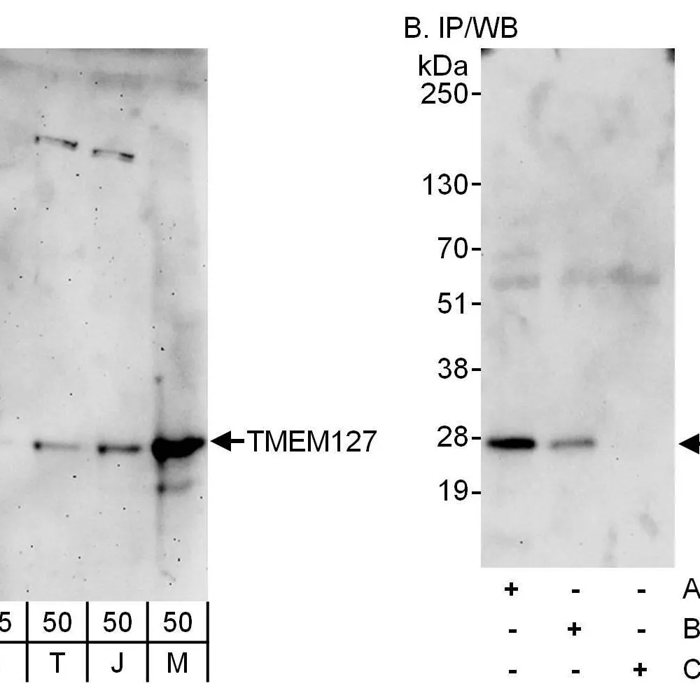 Rabbit anti-TMEM127 Antibody, Affinity Purified