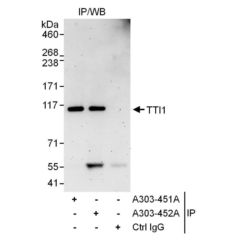 Rabbit anti-TTI1 Antibody, Affinity Purified