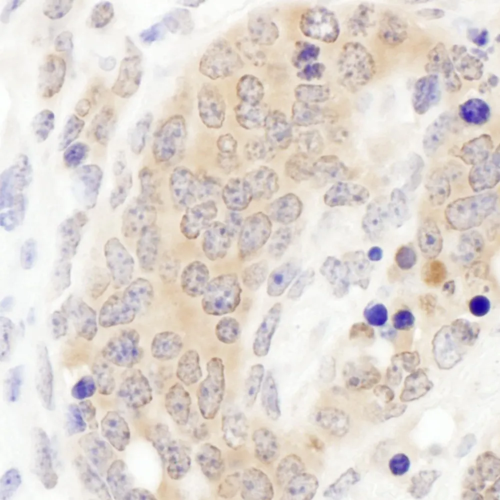 Rabbit anti-CCT3 Antibody, Affinity Purified