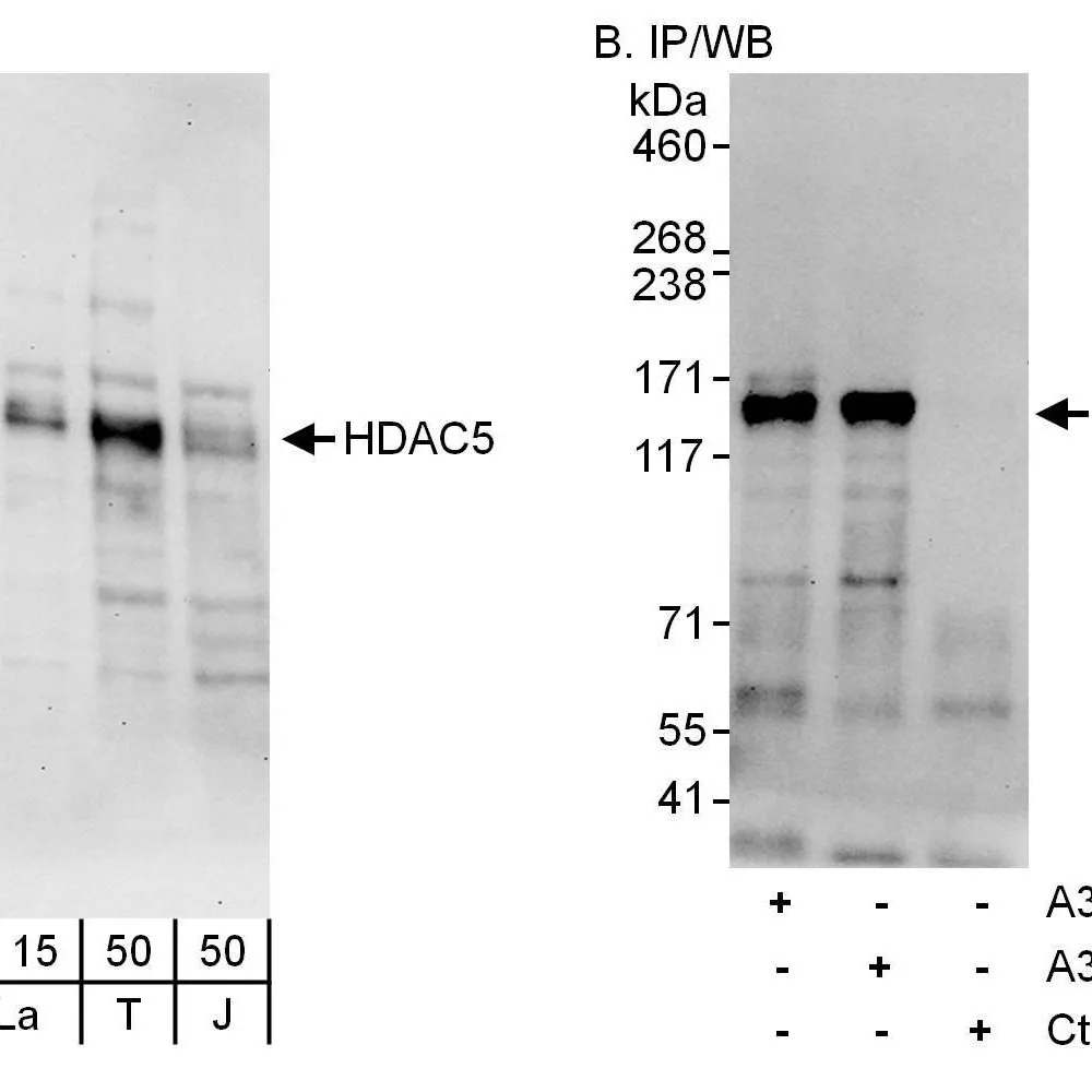 Rabbit anti-HDAC5 Antibody, Affinity Purified