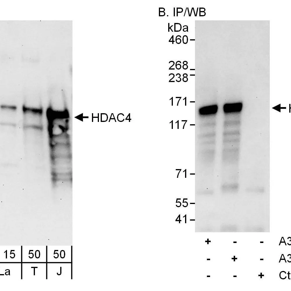 Rabbit anti-HDAC4 Antibody, Affinity Purified