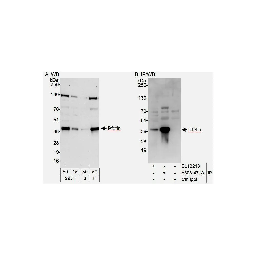 Rabbit anti-Pfetin Antibody, Affinity Purified