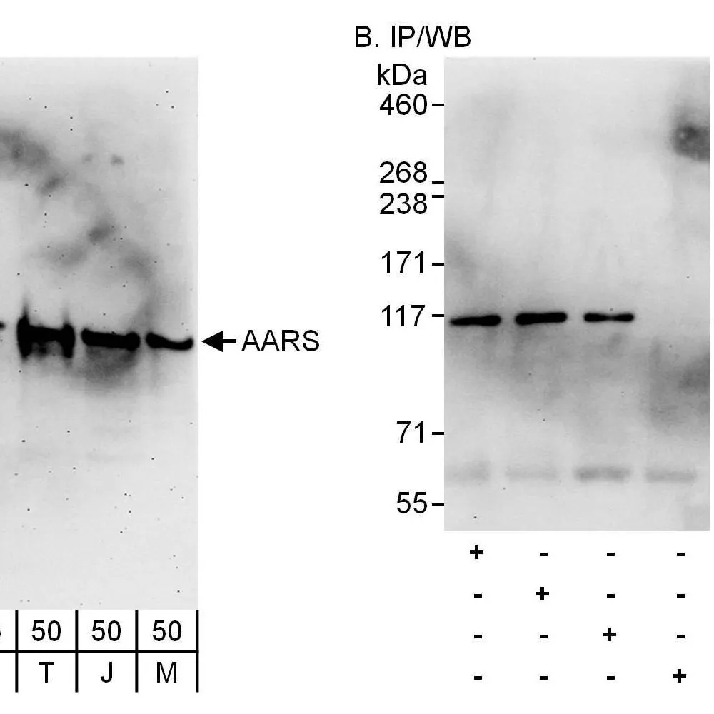 Rabbit anti-AARS Antibody, Affinity Purified