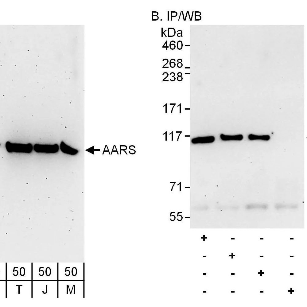 Rabbit anti-AARS Antibody, Affinity Purified