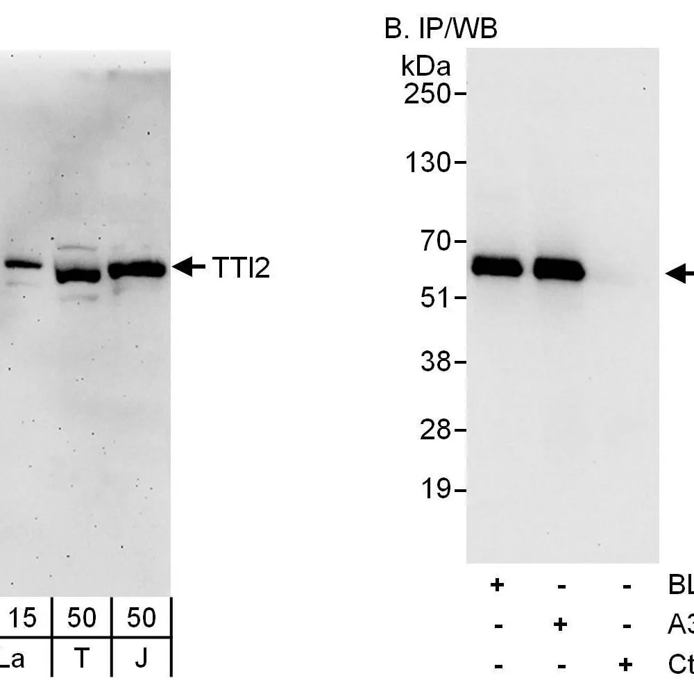 Rabbit anti-TTI2 Antibody, Affinity Purified