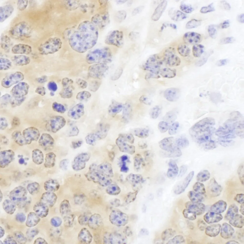 Rabbit anti-CCT2 Antibody, Affinity Purified