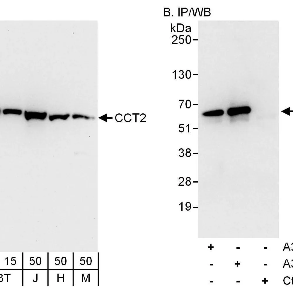 Rabbit anti-CCT2 Antibody, Affinity Purified