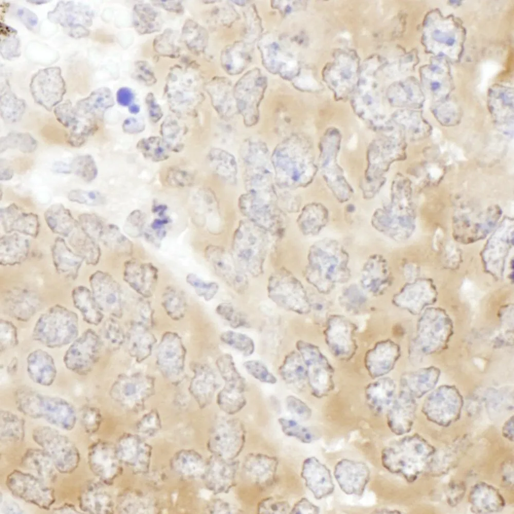 Rabbit anti-CCT5 Antibody, Affinity Purified