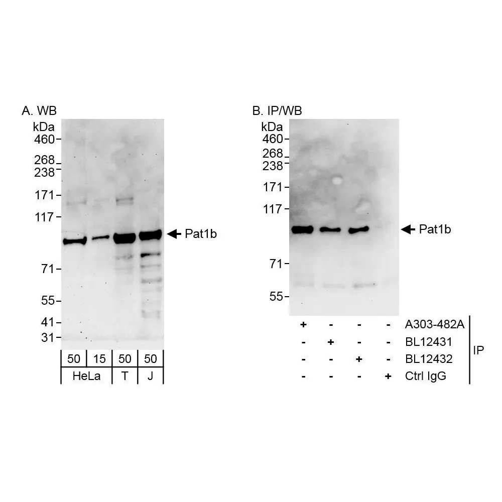 Rabbit anti-Pat1b Antibody, Affinity Purified