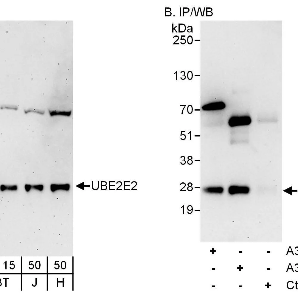 Rabbit anti-UBE2E2 Antibody, Affinity Purified