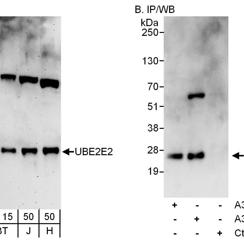 Rabbit anti-UBE2E2 Antibody, Affinity Purified