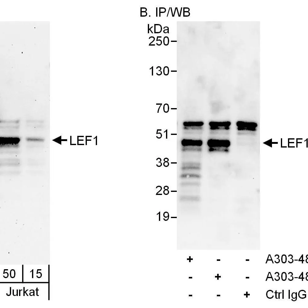 Rabbit anti-LEF1 Antibody, Affinity Purified