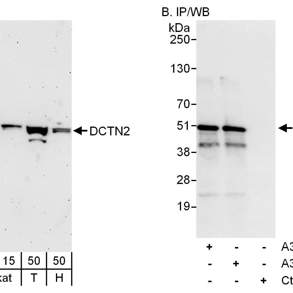 Rabbit anti-DCTN2 Antibody, Affinity Purified