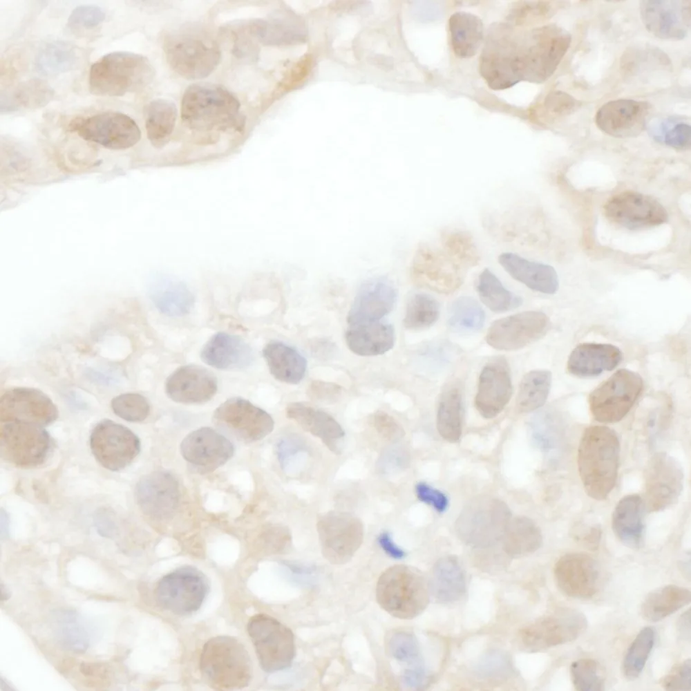 Rabbit anti-Cyclin T1 Antibody, Affinity Purified