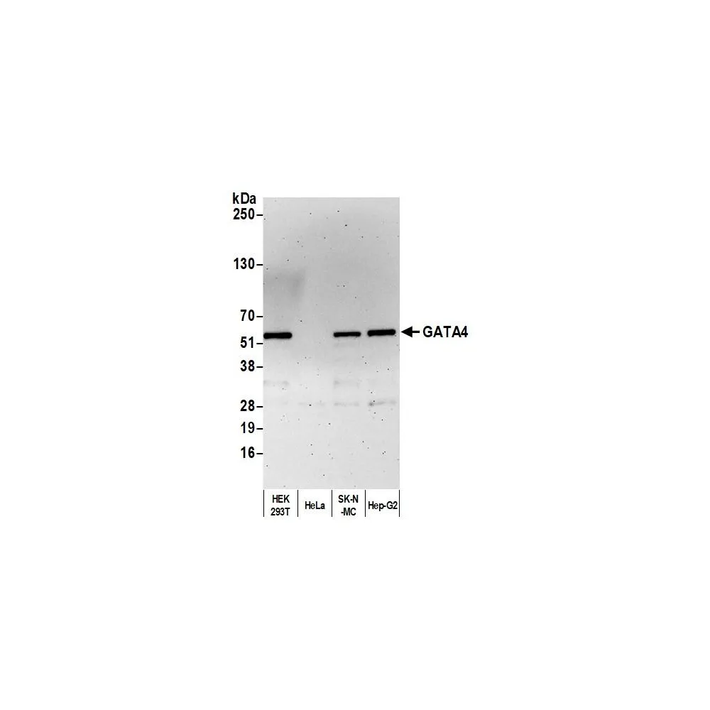 Rabbit anti-GATA4 Antibody, Affinity Purified