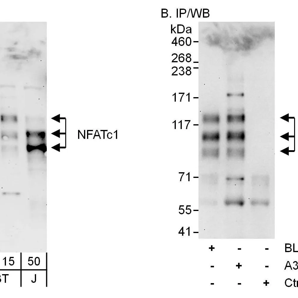 Rabbit anti-NFATc1 Antibody, Affinity Purified